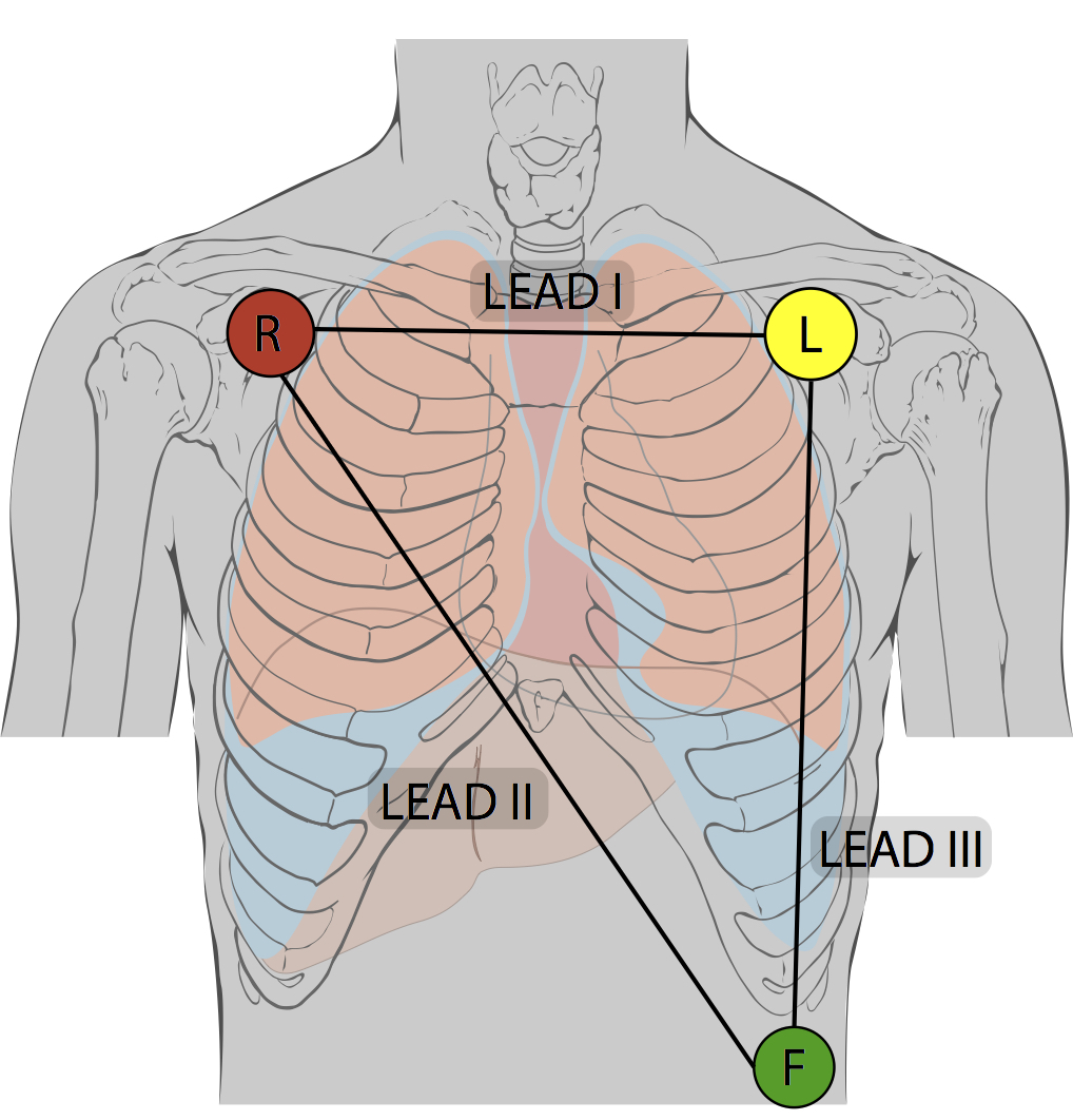 Lead Gradian Health Systems